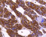 Calreticulin Antibody in Immunohistochemistry (Paraffin) (IHC (P))