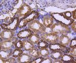 Calreticulin Antibody in Immunohistochemistry (Paraffin) (IHC (P))