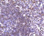 p27 Kip1 Antibody in Immunohistochemistry (Paraffin) (IHC (P))