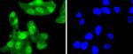 p16INK4a Antibody in Immunocytochemistry (ICC/IF)