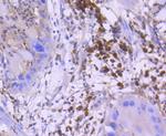 Active/Pro-Caspase 3 Antibody in Immunohistochemistry (Paraffin) (IHC (P))