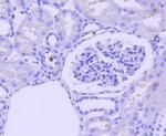 Active/Pro-Caspase 3 Antibody in Immunohistochemistry (Paraffin) (IHC (P))