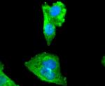 MYLK Antibody in Immunocytochemistry (ICC/IF)