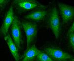 MYLK Antibody in Immunocytochemistry (ICC/IF)