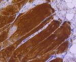 MYLK Antibody in Immunohistochemistry (Paraffin) (IHC (P))