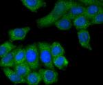 M-CSF Antibody in Immunocytochemistry (ICC/IF)