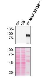 M-CSF Antibody in Immunoprecipitation (IP)