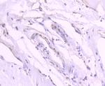 Phospho-GATA3 (Ser308) Antibody in Immunohistochemistry (Paraffin) (IHC (P))