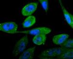 Androgen Receptor Antibody in Immunocytochemistry (ICC/IF)