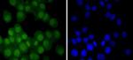 Androgen Receptor Antibody in Immunocytochemistry (ICC/IF)