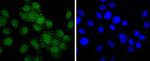 Androgen Receptor Antibody in Immunocytochemistry (ICC/IF)