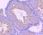 Androgen Receptor Antibody in Immunohistochemistry (Paraffin) (IHC (P))