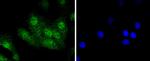 Aurora A Antibody in Immunocytochemistry (ICC/IF)