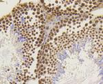 ASH2L Antibody in Immunohistochemistry (Paraffin) (IHC (P))