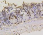 ASH2L Antibody in Immunohistochemistry (Paraffin) (IHC (P))