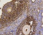 ASH2L Antibody in Immunohistochemistry (Paraffin) (IHC (P))