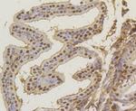 ASH2L Antibody in Immunohistochemistry (Paraffin) (IHC (P))