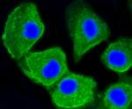 LC3A Antibody in Immunocytochemistry (ICC/IF)