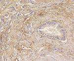 LC3A Antibody in Immunohistochemistry (Paraffin) (IHC (P))