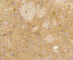 RAB5 Antibody in Immunohistochemistry (Paraffin) (IHC (P))