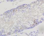 PIK3R2 Antibody in Immunohistochemistry (Paraffin) (IHC (P))