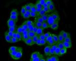 mGluR5 Antibody in Immunocytochemistry (ICC/IF)