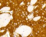 mGluR5 Antibody in Immunohistochemistry (Paraffin) (IHC (P))