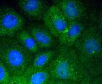 Vitronectin Antibody in Immunocytochemistry (ICC/IF)