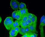 Vitronectin Antibody in Immunocytochemistry (ICC/IF)