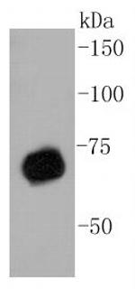 PRMT5 Antibody in Western Blot (WB)