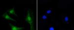 PKC beta-2 Antibody in Immunocytochemistry (ICC/IF)