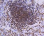 PKC beta-2 Antibody in Immunohistochemistry (Paraffin) (IHC (P))