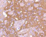 PKC beta-2 Antibody in Immunohistochemistry (Paraffin) (IHC (P))