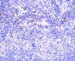 PKC beta-2 Antibody in Immunohistochemistry (Paraffin) (IHC (P))