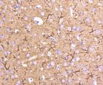 beta Tubulin 2,4 Antibody in Immunohistochemistry (Paraffin) (IHC (P))