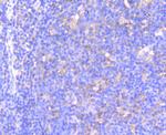 Phospho-MEK1 (Ser218, Ser222) Antibody in Immunohistochemistry (Paraffin) (IHC (P))