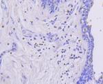 Phospho-MEK1 (Ser218, Ser222) Antibody in Immunohistochemistry (Paraffin) (IHC (P))