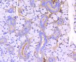 ROCK1 Antibody in Immunohistochemistry (Paraffin) (IHC (P))