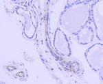 ROCK1 Antibody in Immunohistochemistry (Paraffin) (IHC (P))