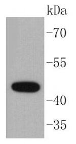 Cytokeratin 15 Antibody in Western Blot (WB)