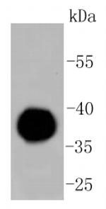 Human IgG4 Antibody in Western Blot (WB)