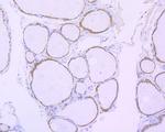 Cyclophilin B Antibody in Immunohistochemistry (Paraffin) (IHC (P))