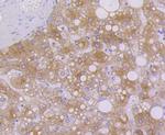 Cytokeratin 7 Antibody in Immunohistochemistry (Paraffin) (IHC (P))