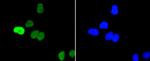 Phospho-c-Myc (Ser62) Antibody in Immunocytochemistry (ICC/IF)