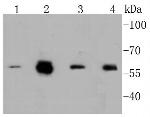 Phospho-c-Myc (Ser62) Antibody in Western Blot (WB)