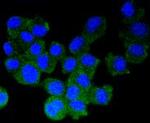 Synuclein alpha/beta Antibody in Immunocytochemistry (ICC/IF)