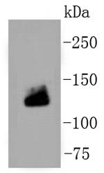 Collagen I Antibody in Western Blot (WB)