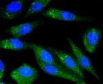 Chk1 Antibody in Immunocytochemistry (ICC/IF)