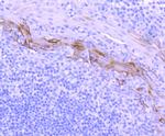 Cytokeratin 10 Antibody in Immunohistochemistry (Paraffin) (IHC (P))