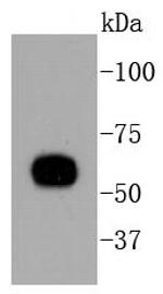 Cytokeratin 10 Antibody in Western Blot (WB)